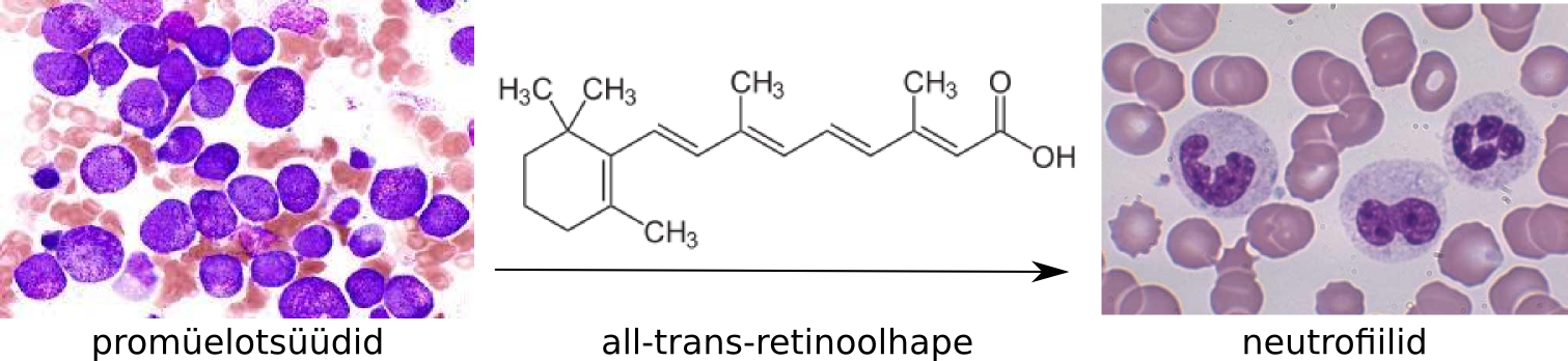 apl